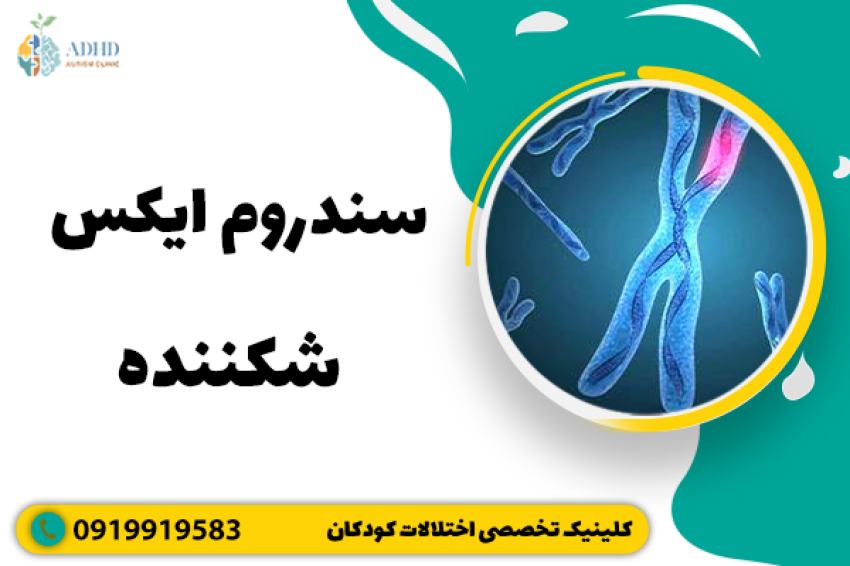 سندروم ایکس شکننده
